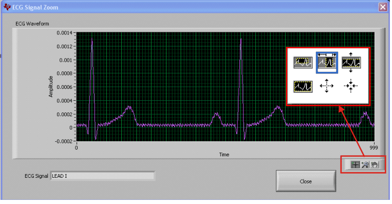 evm_sw_ecg_zoom_lead1_bau171.png