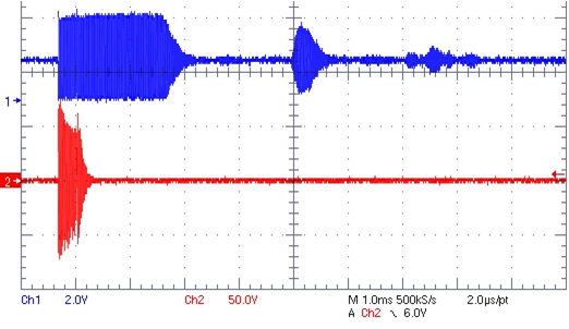 echo_waveform.png