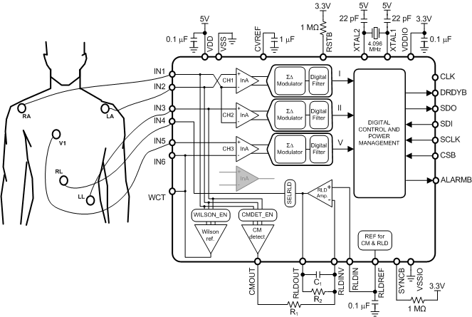 5_lead_example_nas602.gif