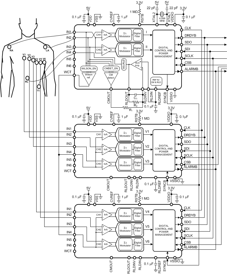 8_12lead_ecg_application_nas602.gif