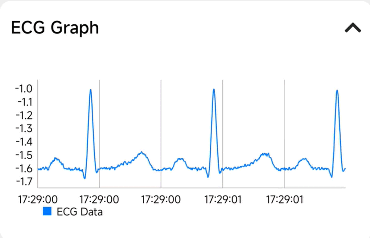 TIDA-010270 ECG 波形 (100BPM)