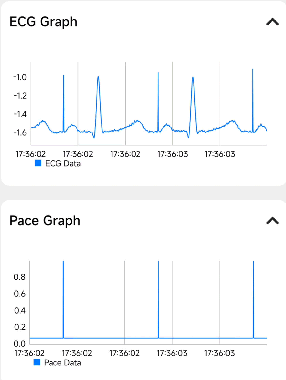 TIDA-010270 70BPM 时的起搏脉冲检测