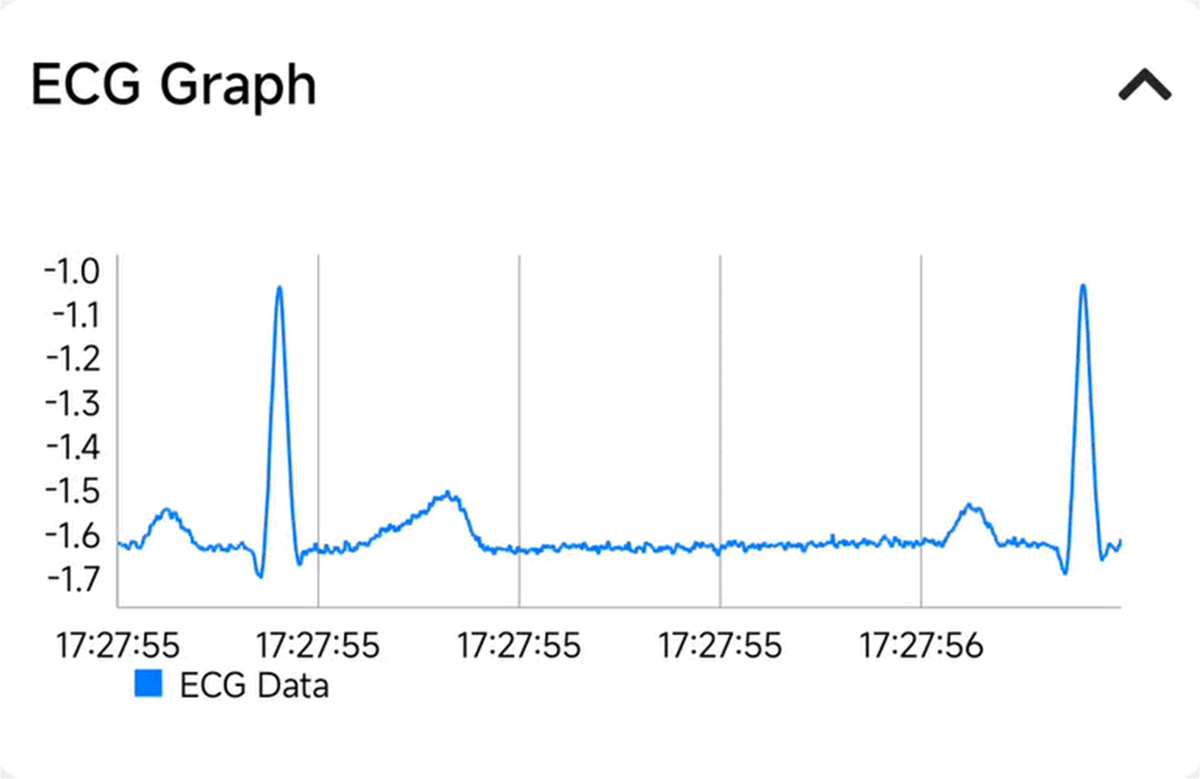 TIDA-010270 ECG 波形 (50BPM)